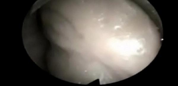  Video internal vagina